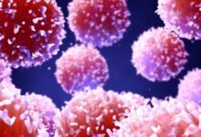 Cellule e mediatori della risposta infiammatoria