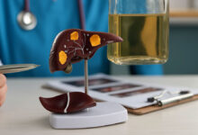 Come spezzare il legame tra alcol e malattie del fegato