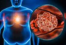 La distribuzione del grasso corporeo e salute cerebrale