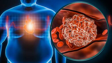 La distribuzione del grasso corporeo e salute cerebrale