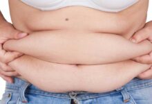 Pericolosità dell’obesità sarcopenica