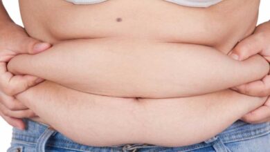 Pericolosità dell’obesità sarcopenica