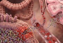 Asse di traslocazione batterica dall’intestino al cervello