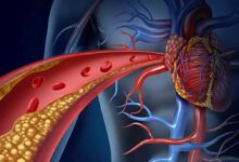 Lipoproteine e apolipoproteine - Patologie genetiche collegate al malfunzionamento del gene APOB