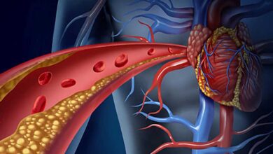 Lipoproteine e apolipoproteine - Patologie genetiche collegate al malfunzionamento del gene APOB