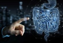 Il fingerprint batterico