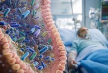 Rischio di sepsi - Il microbiota intestinale modula la suscettibilità dell'ospite e guidano la resistenza all'infezione