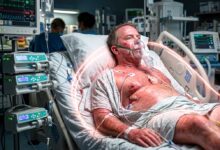 Sindrome da risposta infiammatoria sistemica (SIRS)